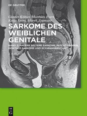 cover image of Andere seltene Sarkome, Mischtumoren, genitale Sarkome und Schwangerschaft